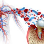 gum disease and inflammation affects whole body health, including heart health
